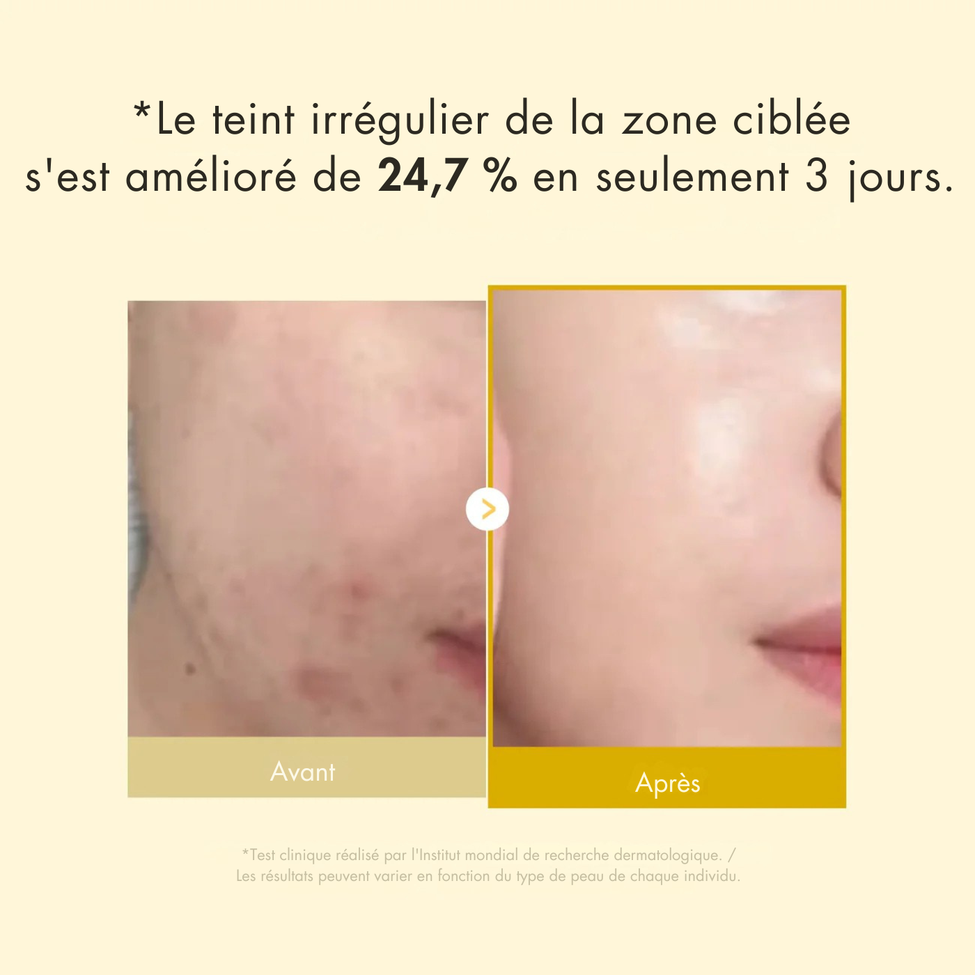 Masque enveloppant à l'acide kojique et au curcuma